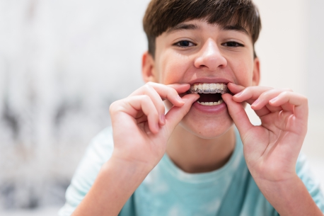 Affordable Aligner Solutions